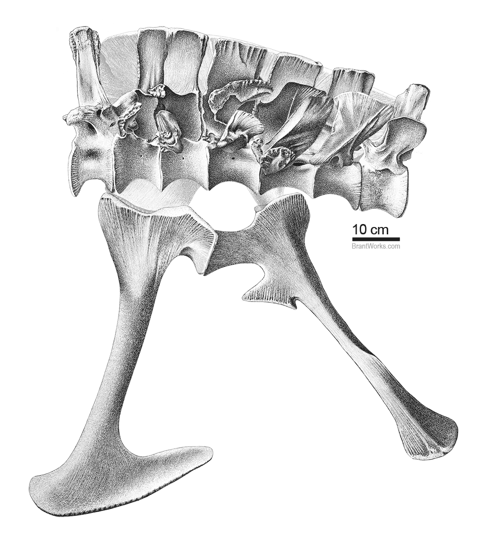 Rotated Pelvis